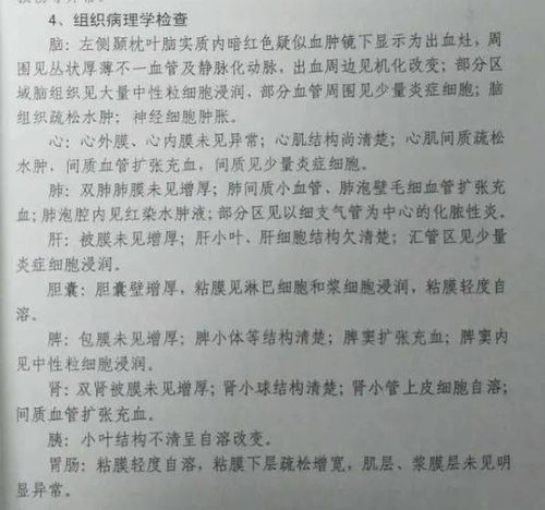 重大事件 17歲少年被拘看守所死亡 后腦袋全軟的,家屬質(zhì)疑因死因,究竟怎么回事